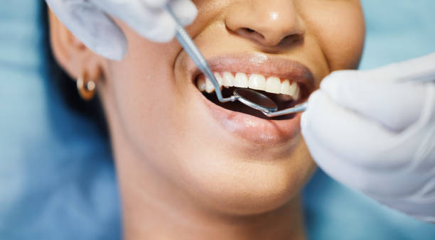 Best Emergency Dental Care for Abscessed Tooth in Laverne, OK