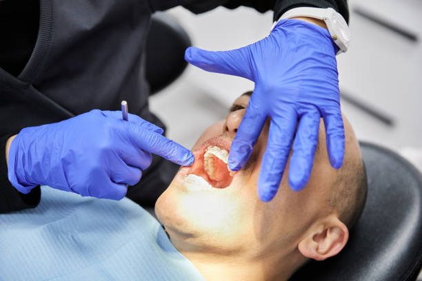 Best Emergency Dental Extractions in Laverne, OK